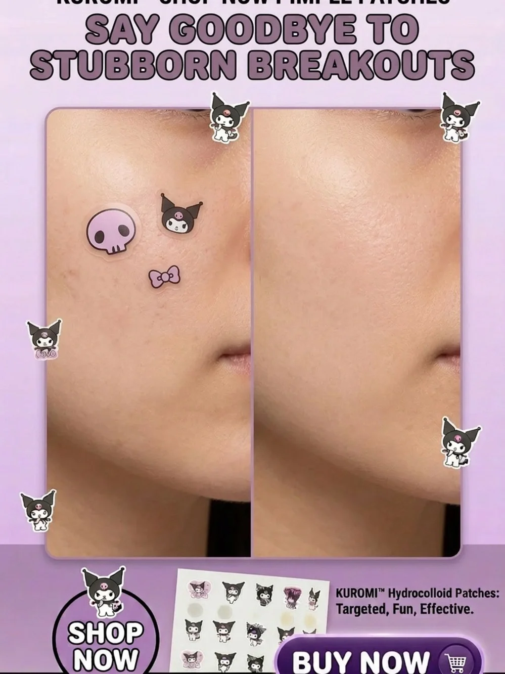 Acne Spot Cover Pimple Patch - Black Cute Cartoon Design